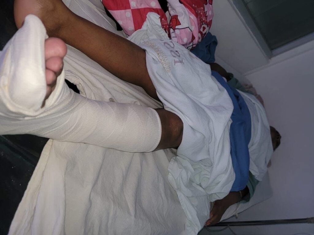 Abandonan a policía lesionada en clínica del ISSSTE de Chetumal 1 0ed1592f 6e6b 4bca b0ab 190890956c82