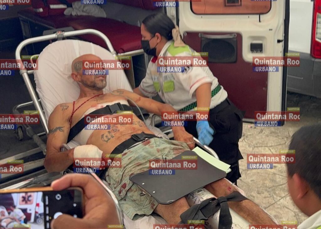 Vecino señalado por violencia y maltrato animal es atacado a balazos en Cancún 1 photo 17569293232138313547606667885194
